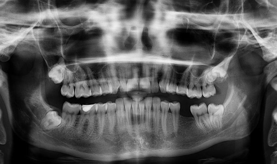 Segurança em Radiologia Odontológica