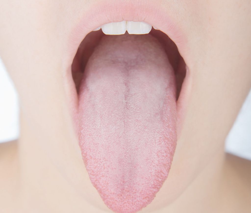 Quatro motivos para intensificar a limpeza da língua