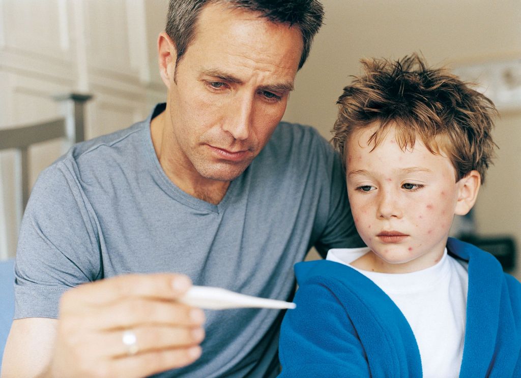 Catapora e a saúde bucal: entenda a relação e os efeitos