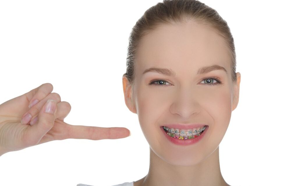 Alinhadores transparentes consolidam avanço na Ortodontia