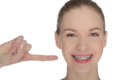 Alinhadores transparentes consolidam avanço na Ortodontia