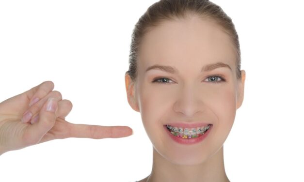 Alinhadores transparentes consolidam avanço na Ortodontia