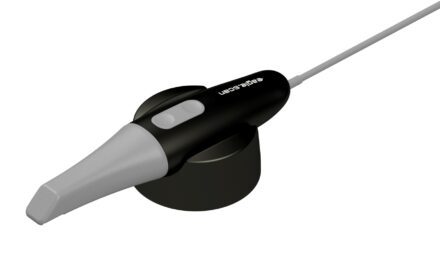 Eagle Scan: primeiro scanner intraoral brasileiro chega ao SUS