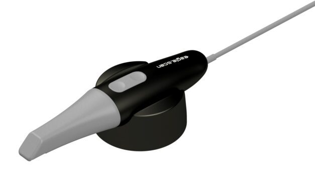 Eagle Scan: primeiro scanner intraoral brasileiro chega ao SUS