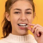 SouSmile lança tratamento mais curto para pequenas correções no sorriso