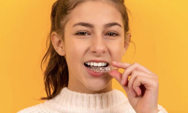 SouSmile lança tratamento mais curto para pequenas correções no sorriso