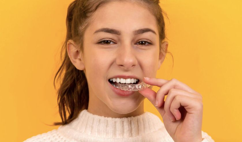 SouSmile lança tratamento mais curto para pequenas correções no sorriso
